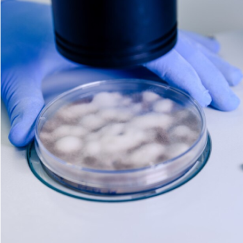La Escuela de Biología UIS presenta a la comunidad educativa y al público en general las líneas de investigación de su Grupo de Investigación en Microbiología y Genética (GIMG). Foto tomada del stock de imágenes donde se ve una muestra del laboratorio.